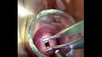 Inserting Things Into Cervix